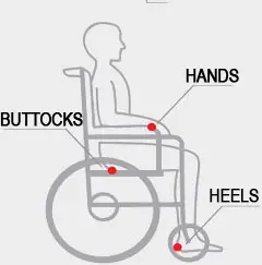 pressure ulcers