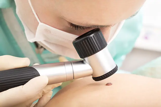 dermatoskopia